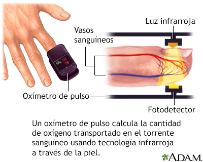 Diferença Entre Oxímetro de Dedo e Pulso: Qual o Melhor para Você? - inspiração 2